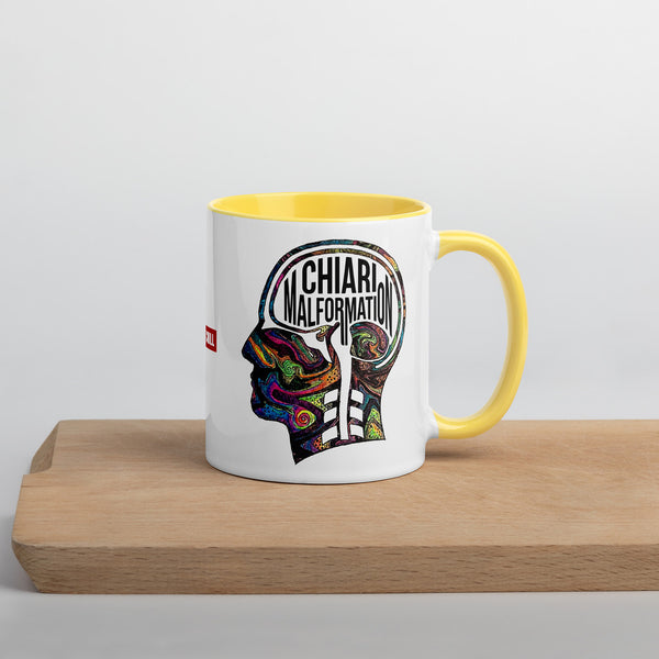 ILLTOCHILL CM Chiari Malformation awareness gift Mug with Color Inside – Lifestyle Right