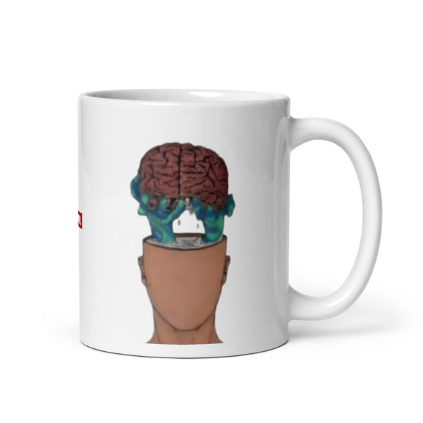 ILLTOCHILL IIH awareness Idiopathic Intracranial Hypertension support gift White glossy mug – Default Handle on Right