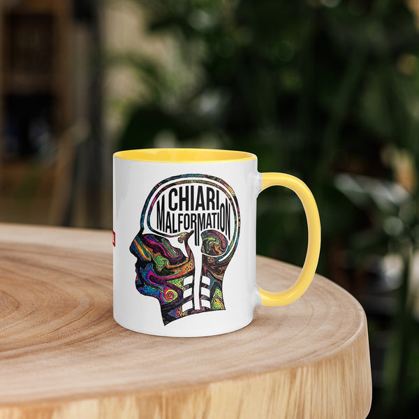 ILLTOCHILL CM Chiari Malformation awareness gift Mug with Color Inside – Lifestyle 5 Right
