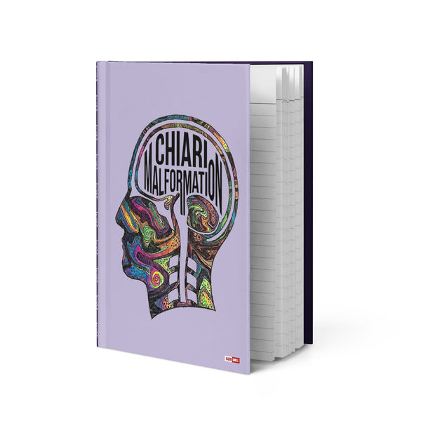 ILLTOCHILL CM Chiari Malformation awareness gift Hardcover journal matte – Flat 2 Front (Illtochill Cm Chiari Malformation Awareness Gift Hardcover Journal Matte)