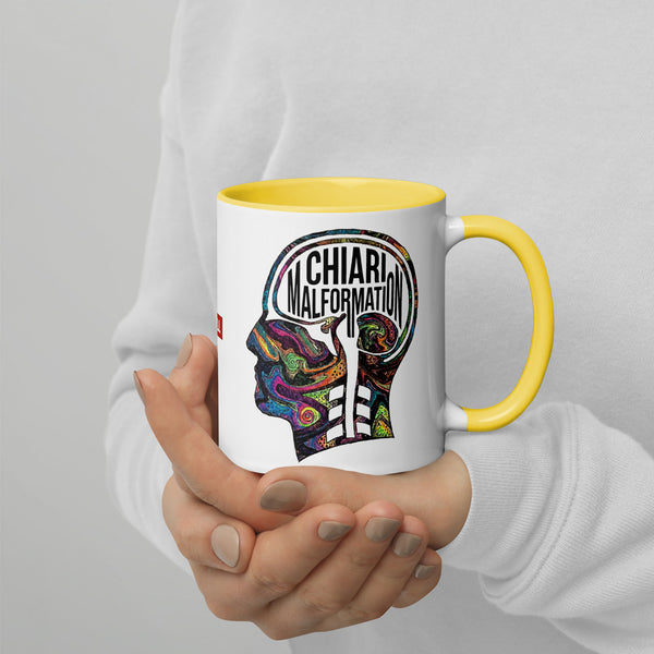 ILLTOCHILL CM Chiari Malformation awareness gift Mug with Color Inside – Lifestyle 4 Right