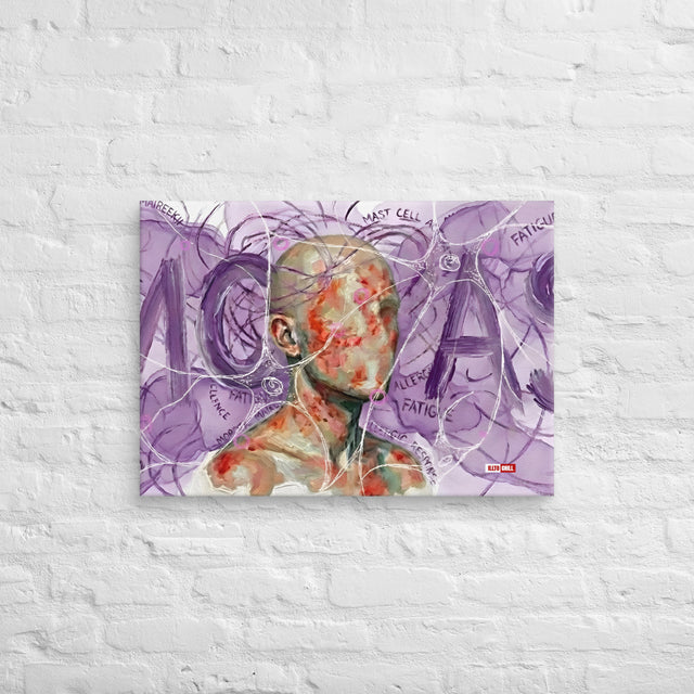 My Body Hates Everything Decor MCAS Canvas by ILLTOCHILL