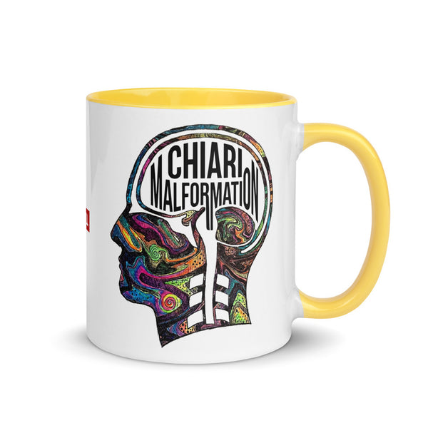ILLTOCHILL CM Chiari Malformation awareness gift Mug with Color Inside – Flat Right