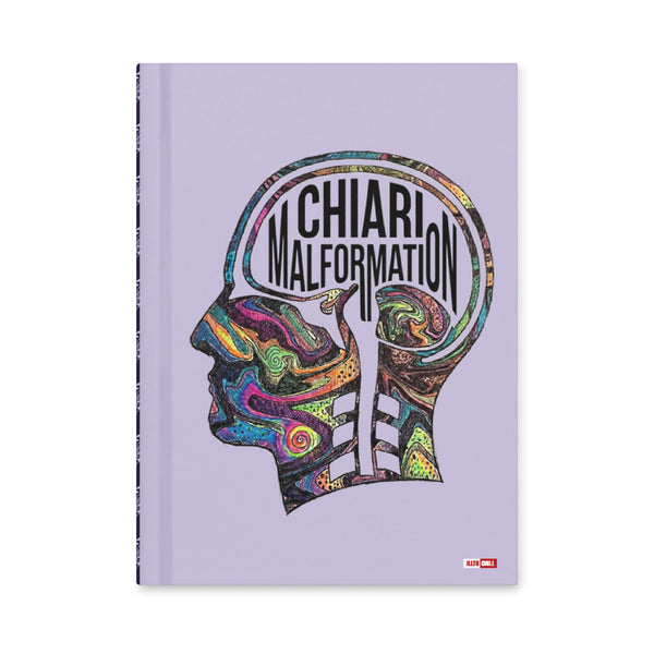 ILLTOCHILL CM Chiari Malformation awareness gift Hardcover journal matte – Flat Front (Illtochill Cm Chiari Malformation Awareness Gift Hardcover Journal Matte)