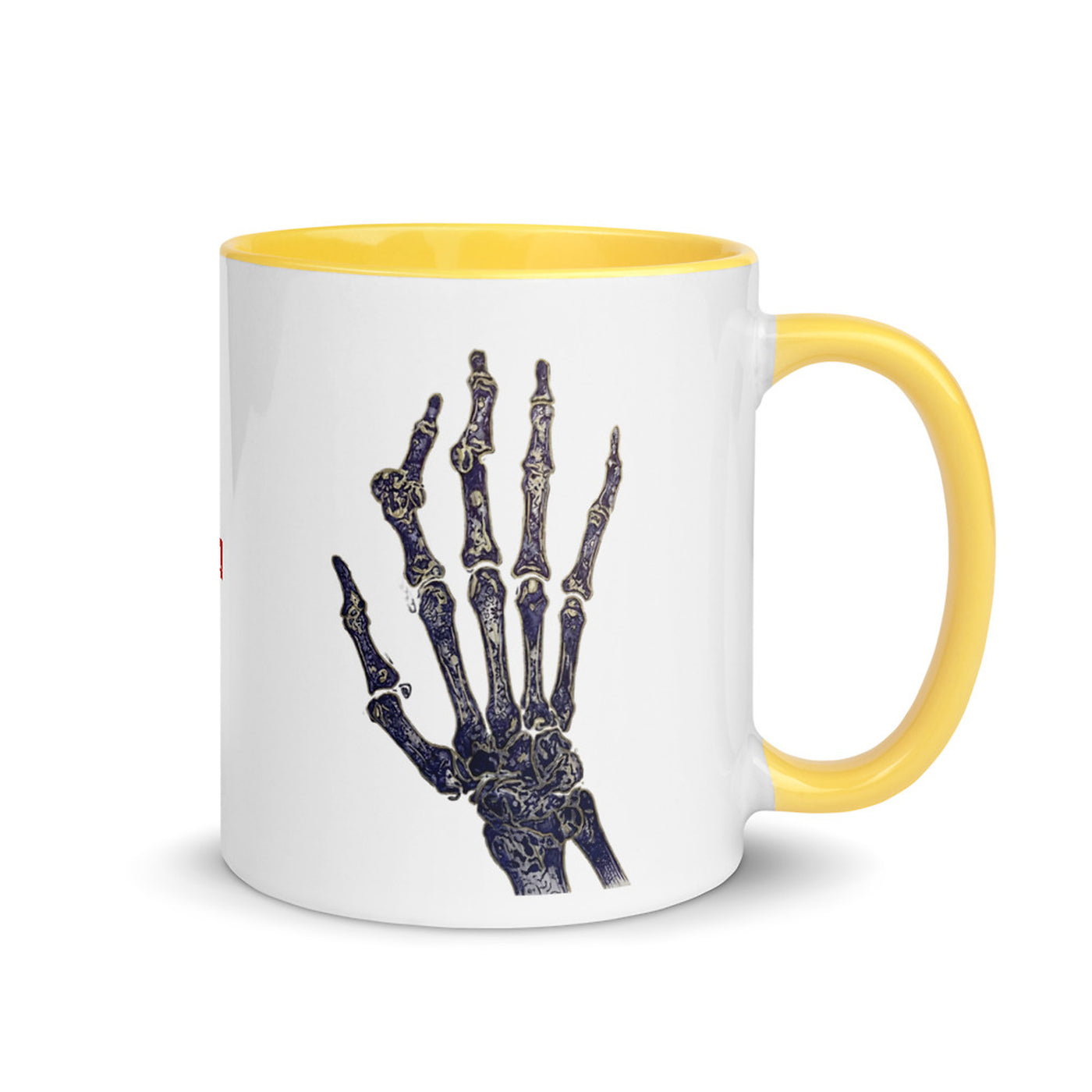 ILLTOCHILL RA awareness Rheumatoid Arthritis support gift Mug with Color Inside – Flat Right