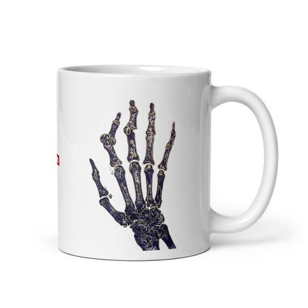 ILLTOCHILL RA awareness Rheumatoid Arthritis support gift White glossy mug – Default Handle on Right