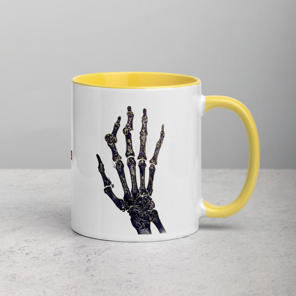 ILLTOCHILL RA awareness Rheumatoid Arthritis support gift Mug with Color Inside – Lifestyle 2 Right