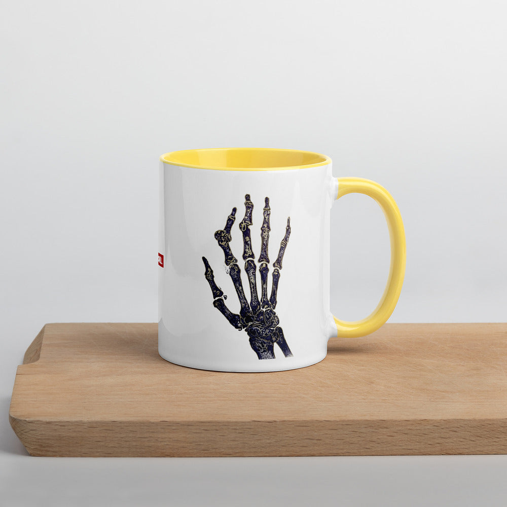 ILLTOCHILL RA awareness Rheumatoid Arthritis support gift Mug with Color Inside – Lifestyle Right