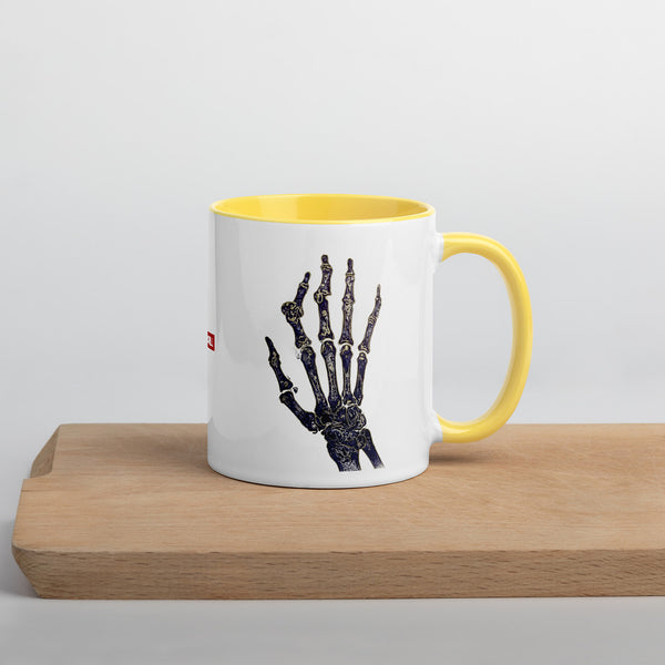 ILLTOCHILL RA awareness Rheumatoid Arthritis support gift Mug with Color Inside – Lifestyle Right