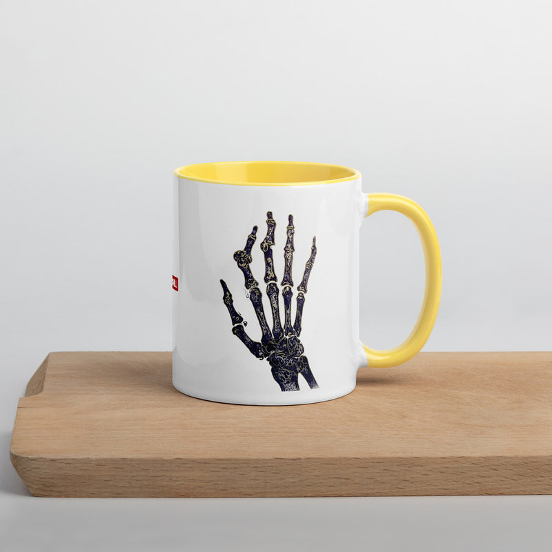 ILLTOCHILL RA awareness Rheumatoid Arthritis support gift Mug with Color Inside – Lifestyle Right