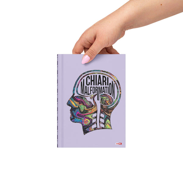 ILLTOCHILL CM Chiari Malformation awareness gift Hardcover journal matte – Lifestyle Front (Illtochill Cm Chiari Malformation Awareness Gift Hardcover Journal Matte)