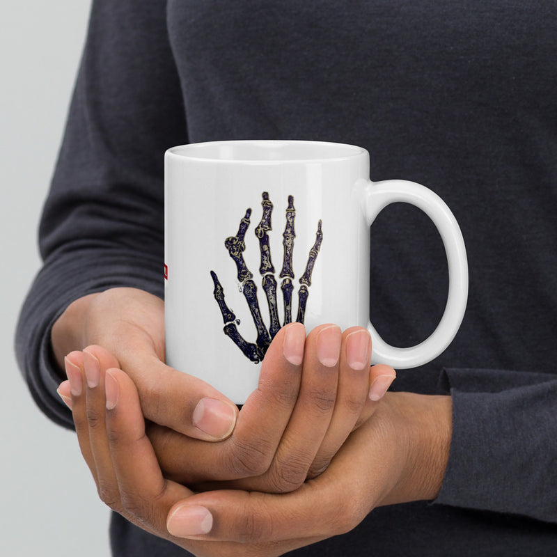 ILLTOCHILL RA awareness Rheumatoid Arthritis support gift White glossy mug – Lifestyle 2 Handle on Right