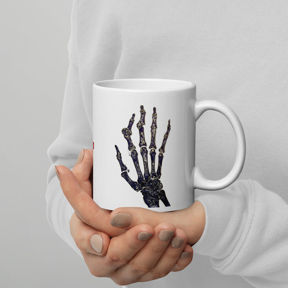 ILLTOCHILL RA awareness Rheumatoid Arthritis support gift White glossy mug – Lifestyle 3 Handle on Right