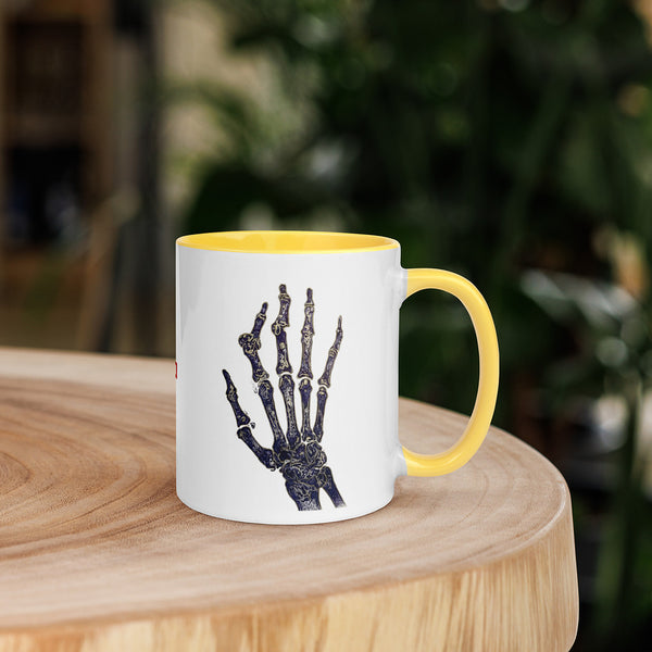 ILLTOCHILL RA awareness Rheumatoid Arthritis support gift Mug with Color Inside – Lifestyle 5 Right
