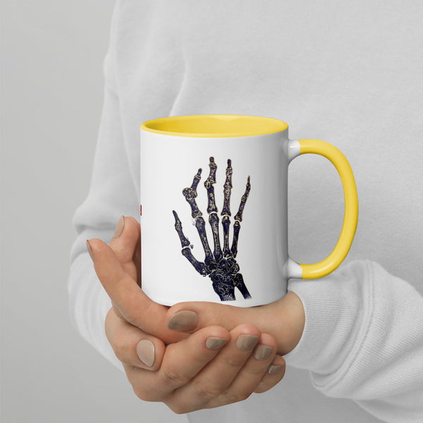 ILLTOCHILL RA awareness Rheumatoid Arthritis support gift Mug with Color Inside – Lifestyle 4 Right