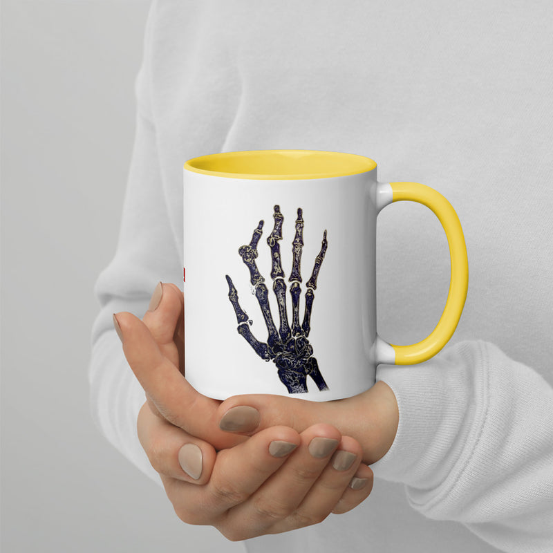 ILLTOCHILL RA awareness Rheumatoid Arthritis support gift Mug with Color Inside – Lifestyle 4 Right