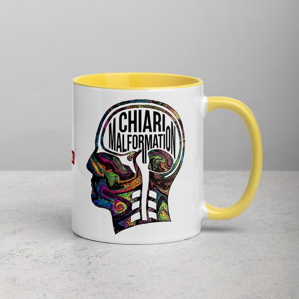 ILLTOCHILL CM Chiari Malformation awareness gift Mug with Color Inside – Lifestyle 2 Right