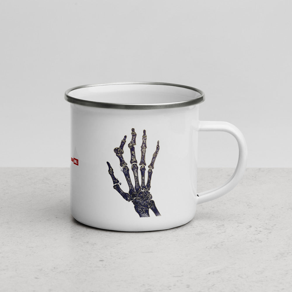 ILLTOCHILL RA awareness Rheumatoid Arthritis support gift Enamel Mug – Lifestyle 3 Right
