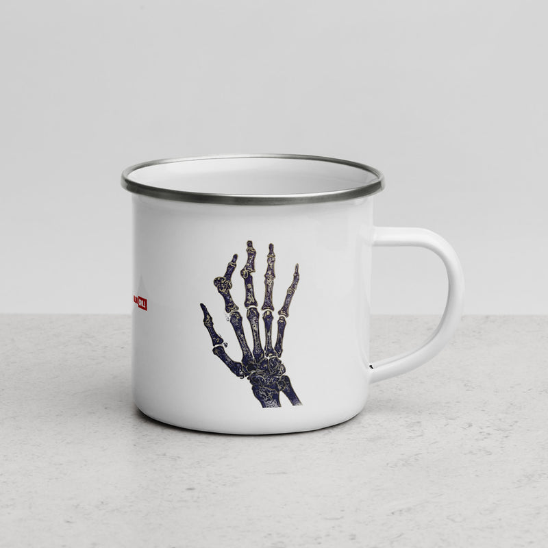 ILLTOCHILL RA awareness Rheumatoid Arthritis support gift Enamel Mug – Lifestyle 3 Right